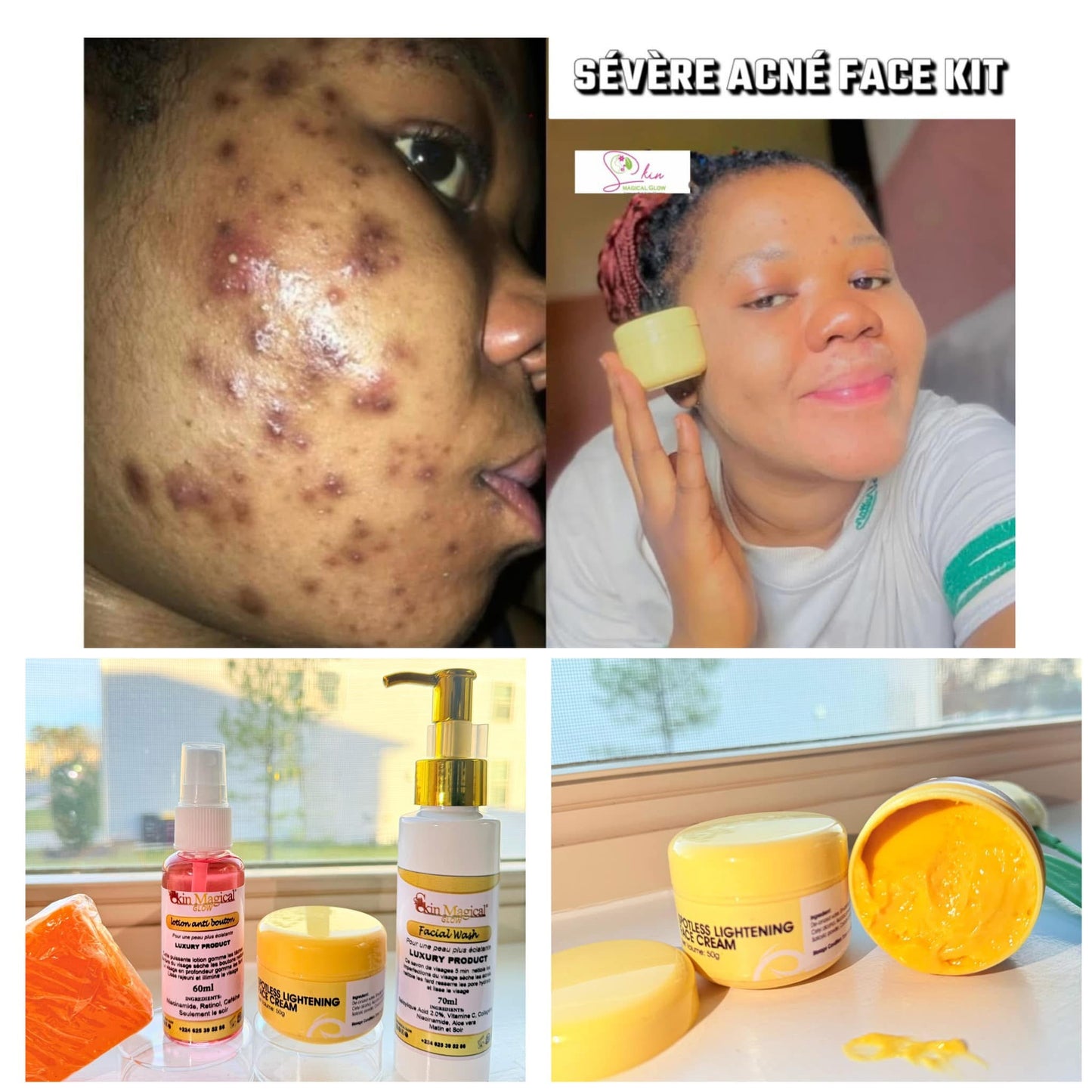 β¨ Spotless Lightening Face Cream