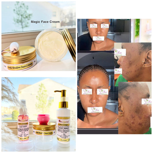 Faciale acné set
