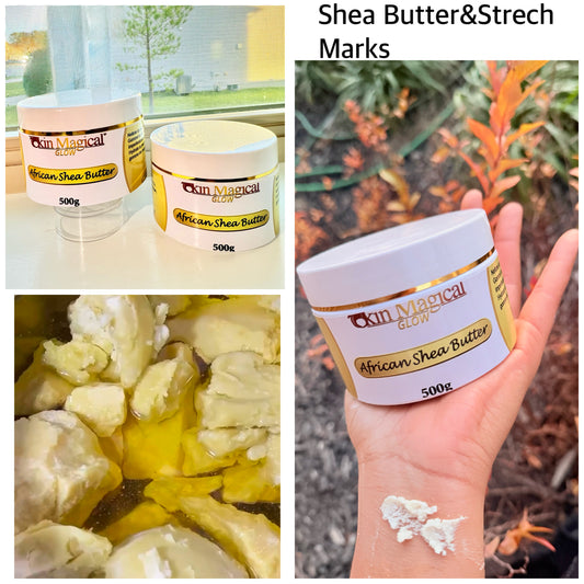 💛 African Shea Butter – 100% Pure (500g)