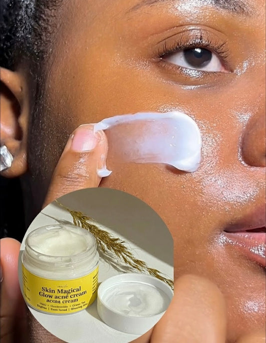 5-in-1 Acne & Dark Spot & Melasma Treatment Cream